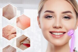 Tige d'électrothérapie à haute onde.